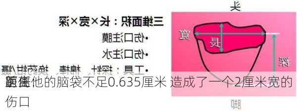 
前任
医生：
距离他的脑袋不足0.635厘米 造成了一个2厘米宽的伤口